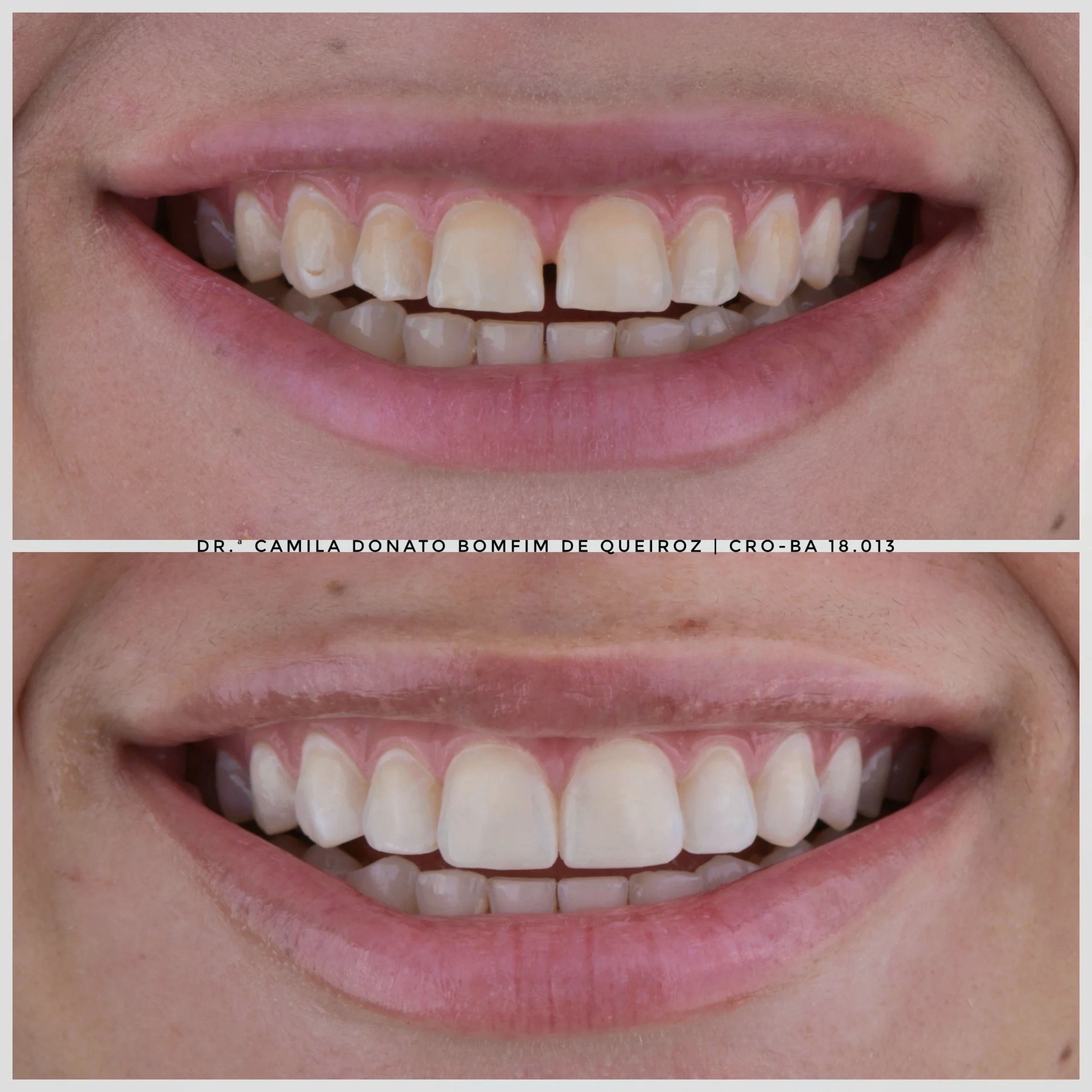 20250301_110849 (1) (1) (1)