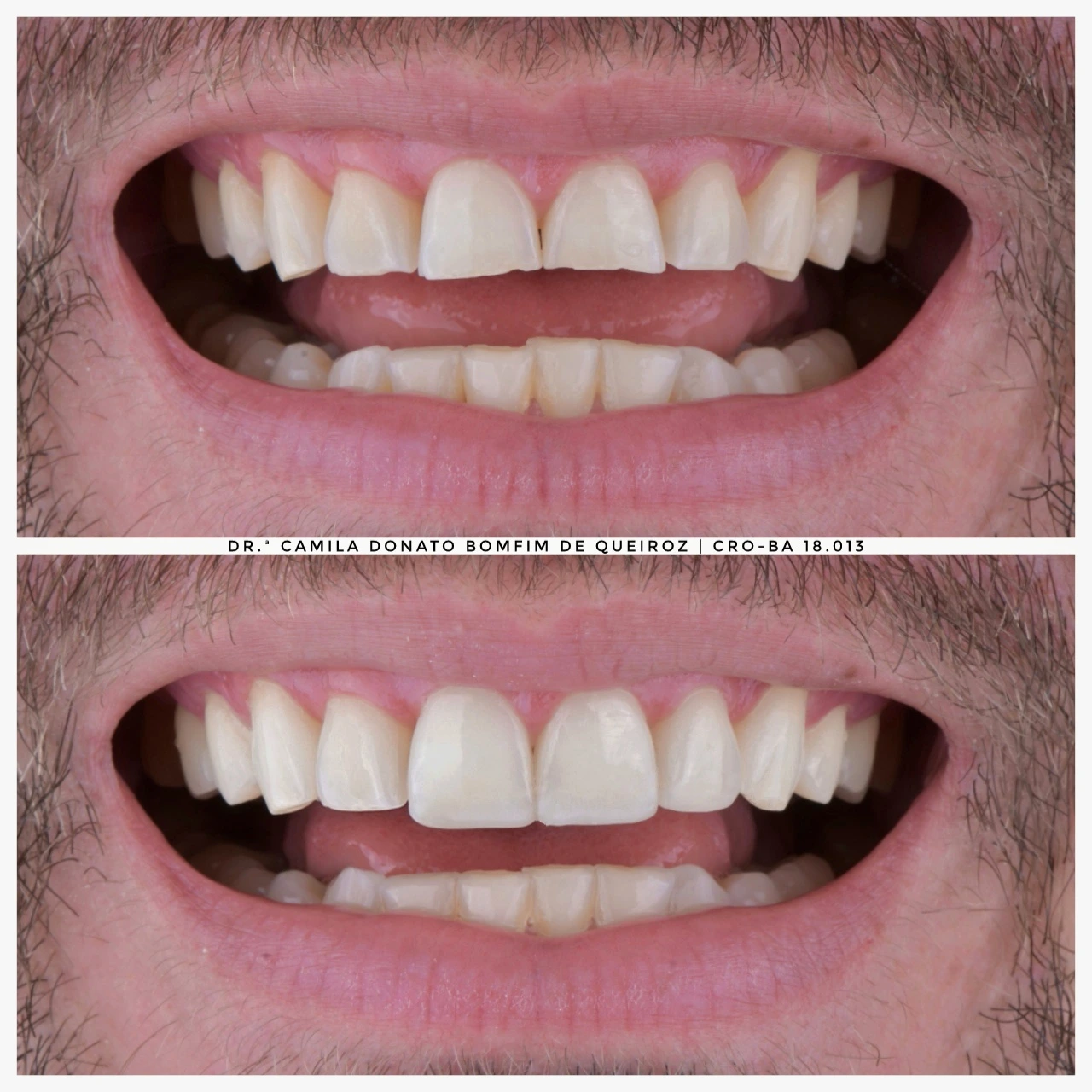 AirBrush_20230913152221-01