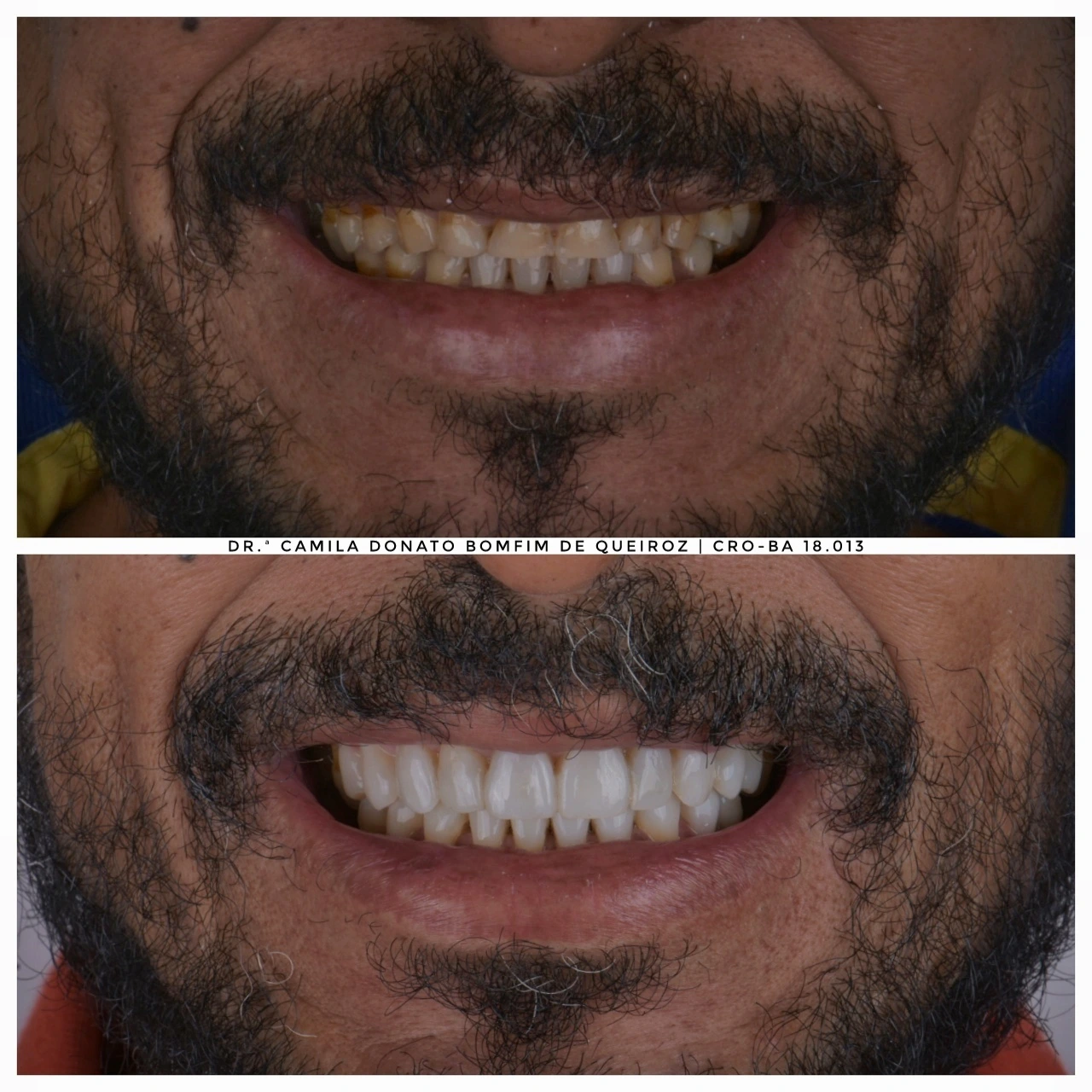 P_20230306_204541-01-01