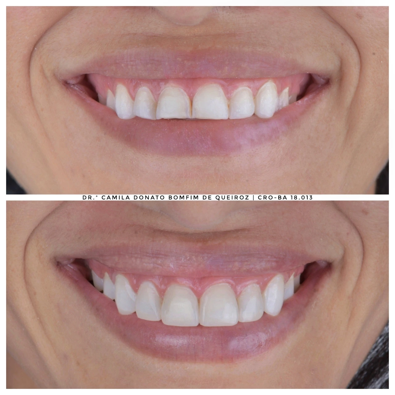 P_20231107_205103-01